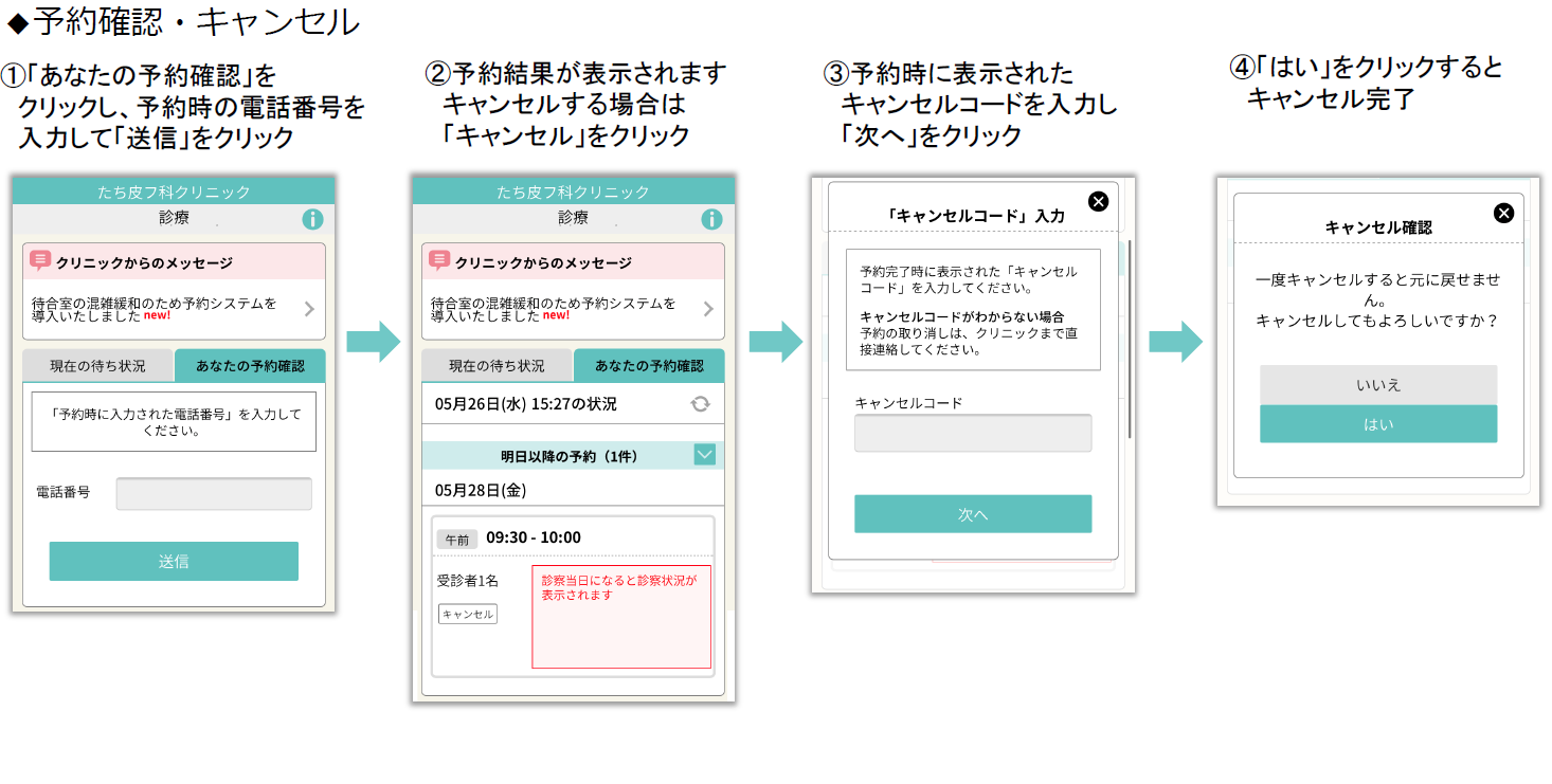 予約手順３